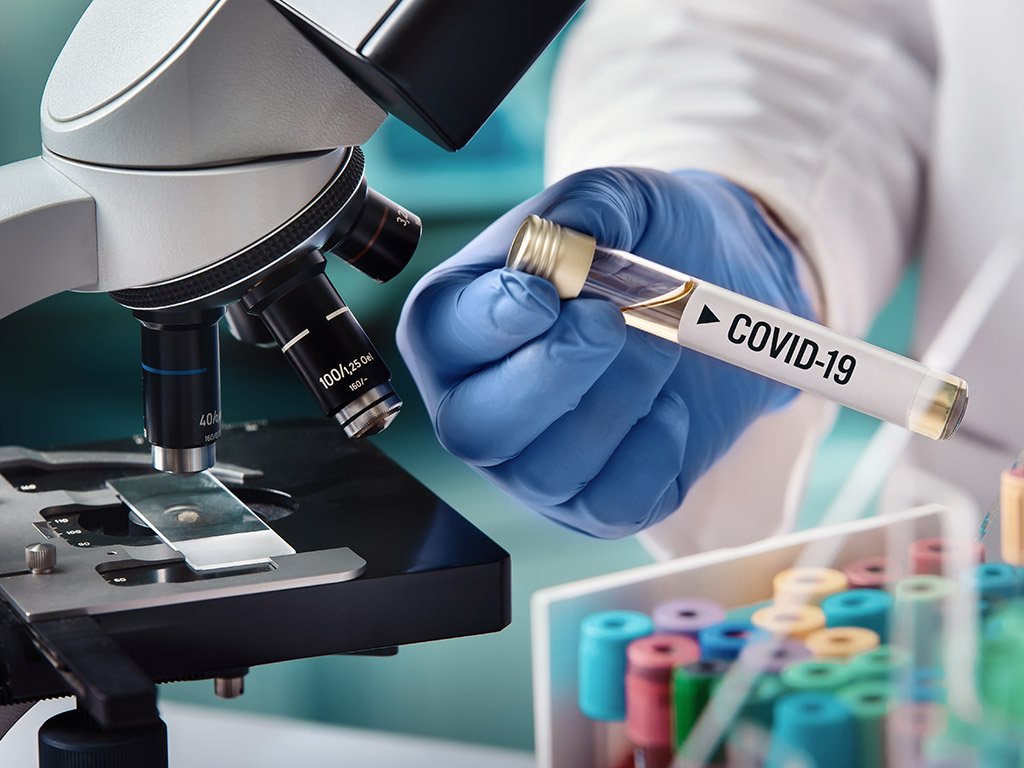 Buisje met label Covid-19